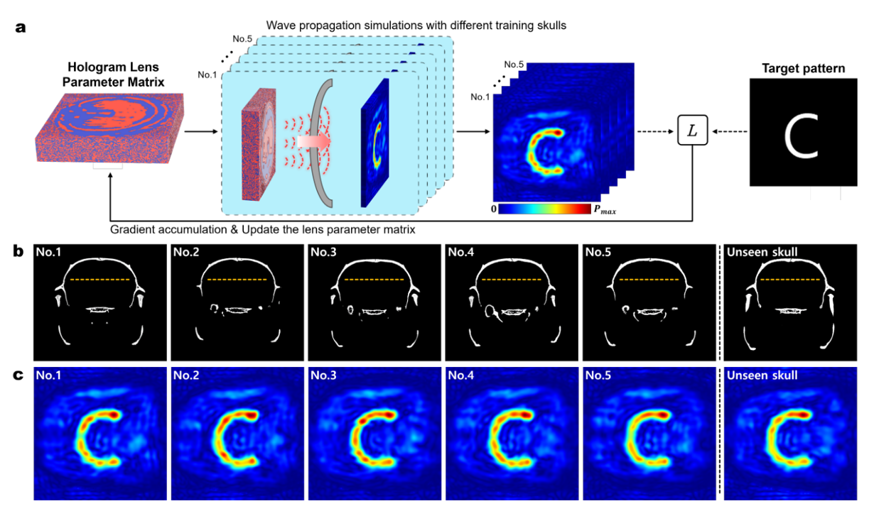 Machine Learning-Enhanced Skull-Universal Acoustic Hologram for Efficient Transcranial Ultrasound Neuromodulation Across Varied Rodent Skulls