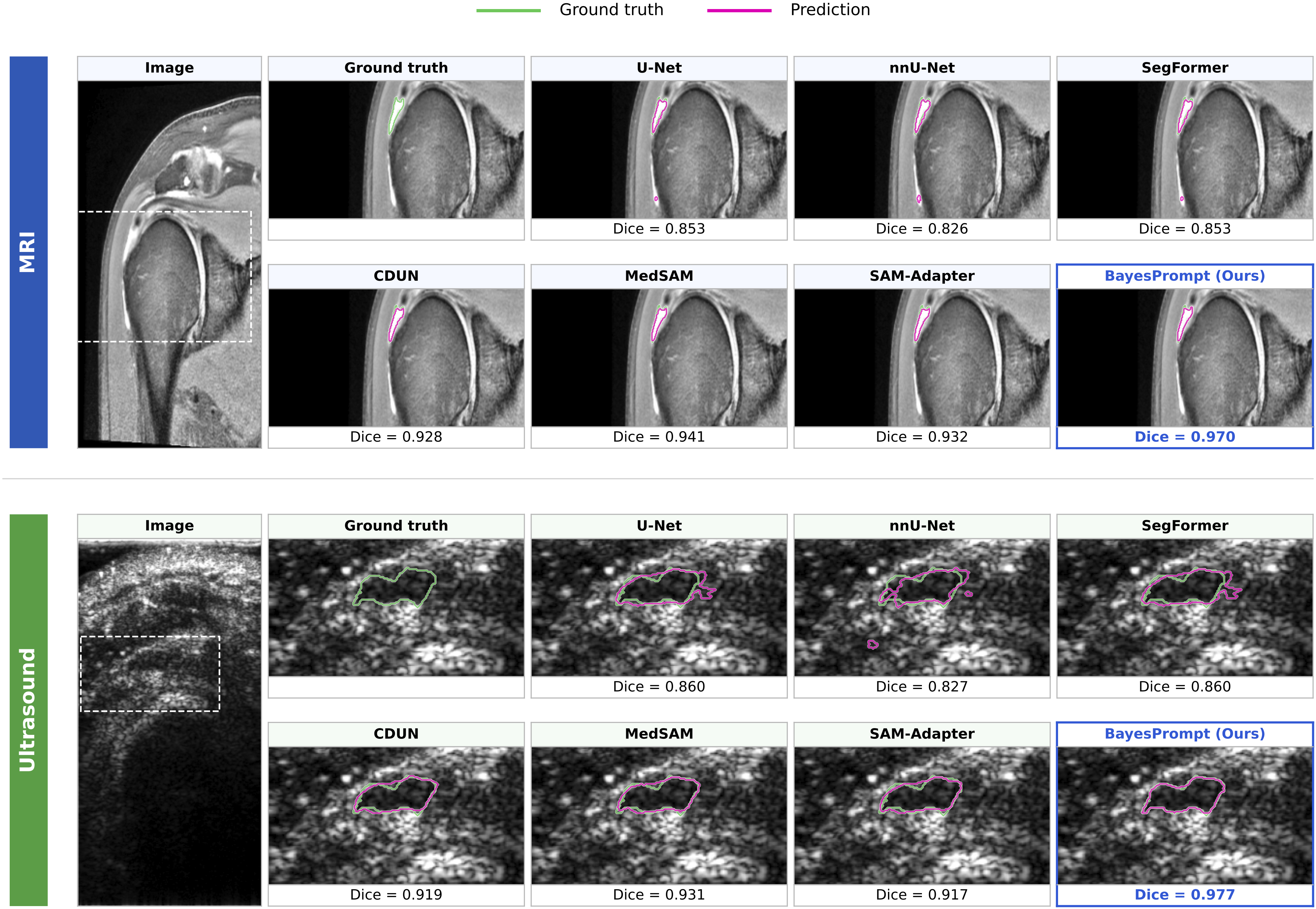Two MICCAI 2026 Papers Accepted as Early Accepts