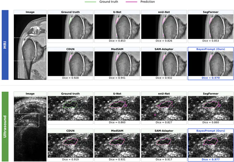 Two MICCAI 2026 Papers Accepted as Early Accepts