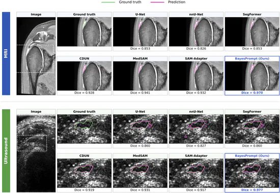 Two MICCAI 2026 Papers Accepted as Early Accepts