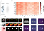 Dynamic Sub-domain Modeling for Robust Medical Image Segmentation