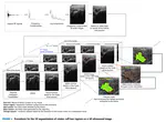 Wide-field 3D Ultrasound Imaging Platform with a Semi-Automatic 3D Segmentation Algorithm for Quantitative Analysis of Rotator Cuff Tears