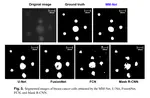 Fully-automatic Deep Learning-based Analysis for Determination of the Invasiveness of Breast Cancer Cells in an Acoustic Trap