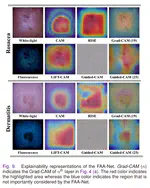 Multi-task and Few-shot Learning-based Fully Automatic Deep Learning Platform for Mobile Diagnosis of Skin Diseases