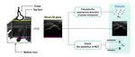 USG-Net: Deep Learning-based Ultrasound Scanning-Guide for an Orthopedic Sonographer