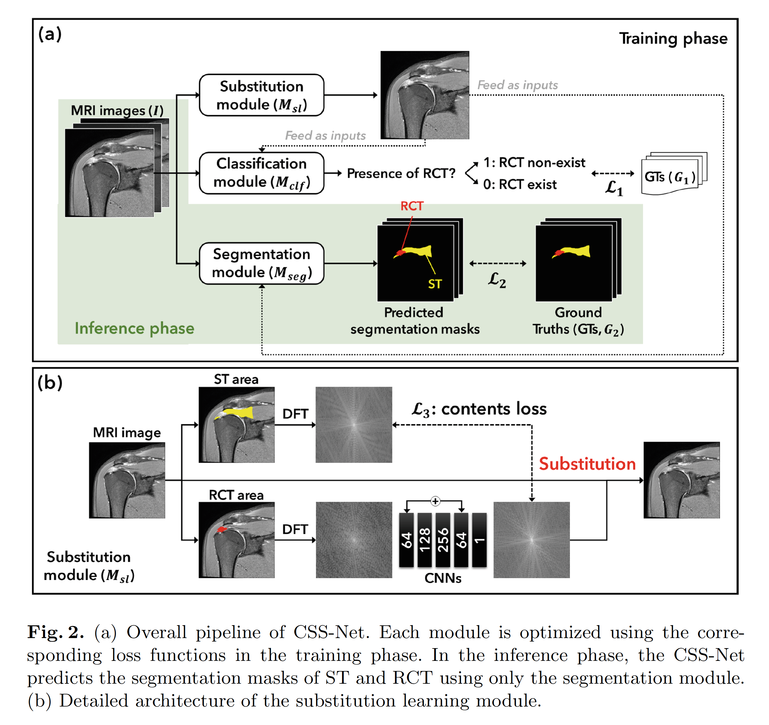 CSS-Net: Classification and Substitution for Segmentation of Rotator Cuff Tear