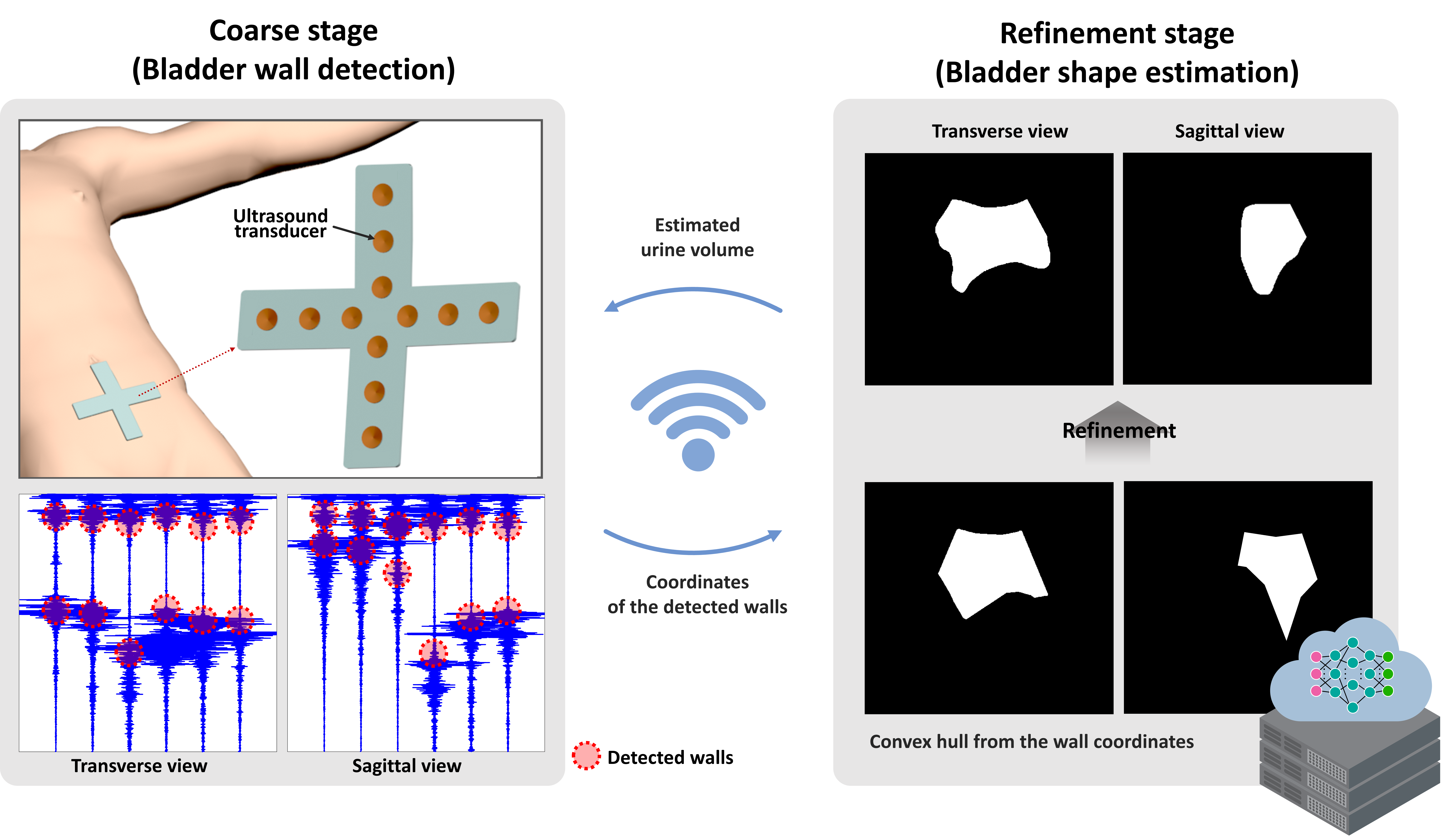 Intelligent Bladder Volume Monitoring for Wearable Ultrasound Devices: Enhancing Accuracy through Deep Learning-based Coarse-to-Fine Shape Estimation