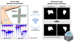 Intelligent Bladder Volume Monitoring for Wearable Ultrasound Devices: Enhancing Accuracy through Deep Learning-based Coarse-to-Fine Shape Estimation